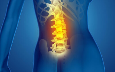 পিএলআইডি (PLID) এবং সায়াটিকা: কোমর ব্যথার স্থায়ী সমাধান যখন জরুরি